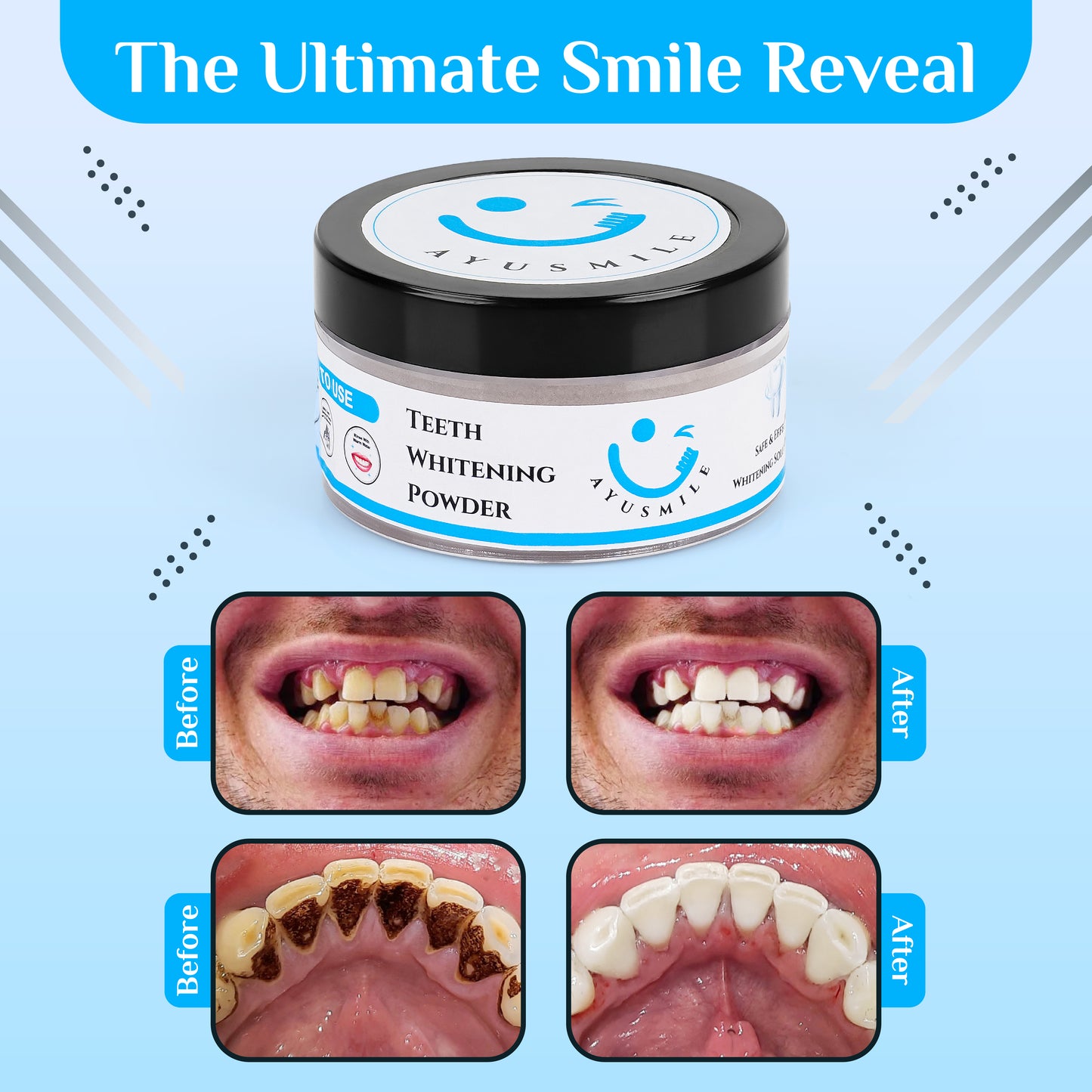 Aayusmile -Herbal Ayurvedic Teeth Whitening Powder 50gms